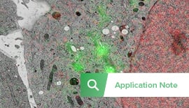 Cellular Biology: In-resin Fluorescence Using GFP and mCherry