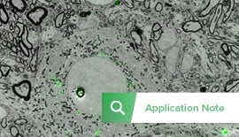 Neuroscience: Synaptic Connectivity in the Songbird Brain