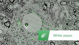 Sample Preparation for Correlative Light and Electron Microscopy